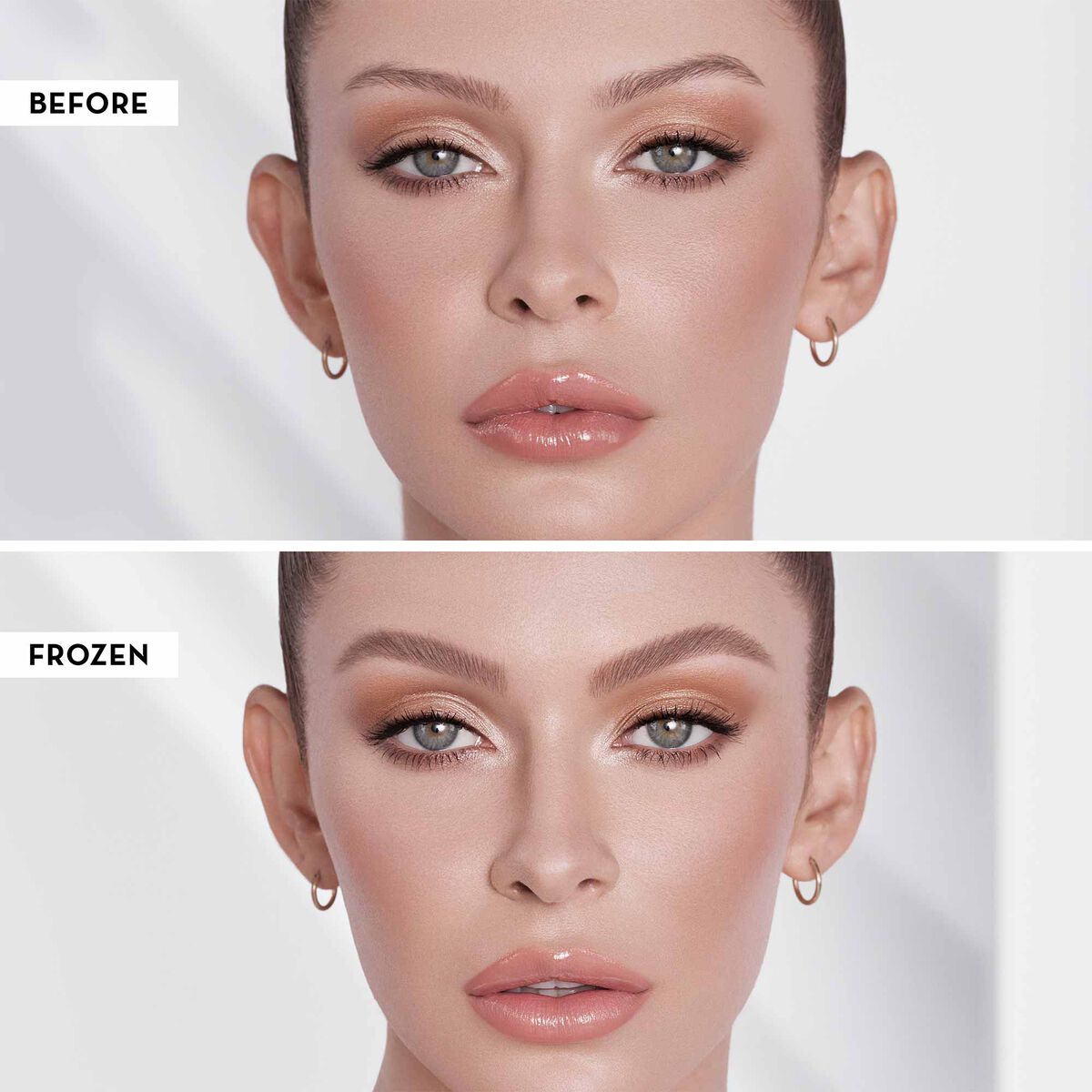 ABH