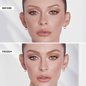 ABH
